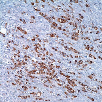 GCDFP-15 (23A3) + Mammaglobin Cocktail (304-1A5 &amp; 31A5) Mouse/Rabbit Monoclonal Antibodies