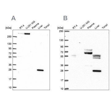 Anti-QDPR antibody produced in rabbit Prestige Antibodies&#174; Powered by Atlas Antibodies, affinity isolated antibody, buffered aqueous glycerol solution