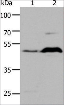 Anty-5HT1A affinity isolated antibody