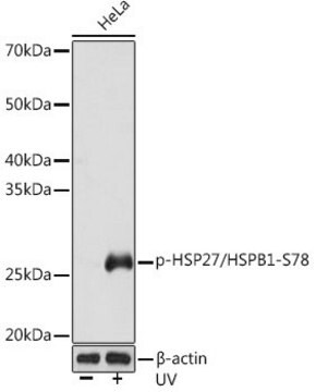 Anti-Phospho-HSP27/HSPB1-S78 antibody produced in rabbit