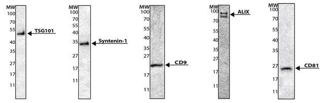 Wzorce egzosomów, fluorescencyjne recombinant, expressed in human cells