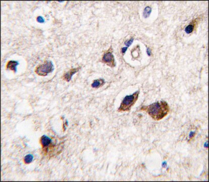 Anti-PKC&#947; (C-term) antibody produced in rabbit IgG fraction of antiserum, buffered aqueous solution