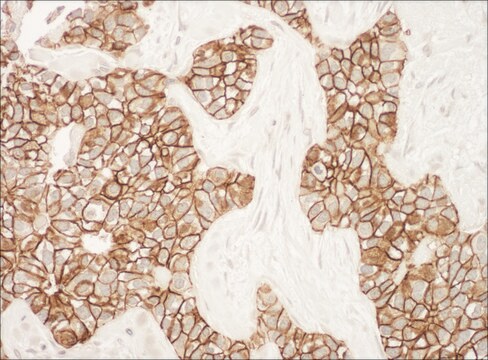 Rabbit anti-ErbB2 Antibody, Affinity Purified Powered by Bethyl Laboratories, Inc.