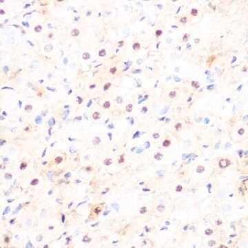 Anti-DP1/TFDP1 antibody produced in rabbit