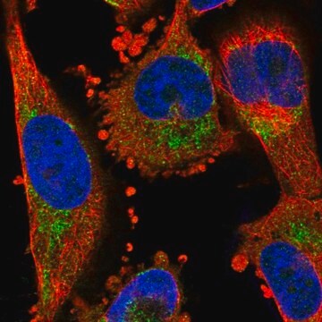 抗NPY1R ウサギ宿主抗体 affinity isolated antibody, buffered aqueous glycerol solution