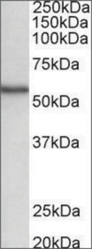 Anti-STK38 antibody produced in goat affinity isolated antibody, buffered aqueous solution