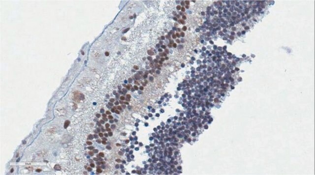 抗-OTX2抗体 from rabbit, purified by affinity chromatography