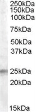 Anti-IGFBP6 antibody produced in goat affinity isolated antibody, buffered aqueous solution