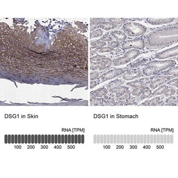 Anti-DSG1 antibody produced in rabbit Prestige Antibodies&#174; Powered by Atlas Antibodies, affinity isolated antibody, buffered aqueous glycerol solution