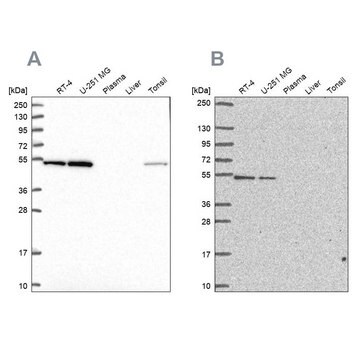 Anty-RUVBL2 Prestige Antibodies&#174; Powered by Atlas Antibodies, affinity isolated antibody