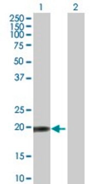 Anti-TPRKB antibody produced in mouse purified immunoglobulin, buffered aqueous solution