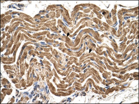 Anti-ATP5B antibody produced in rabbit IgG fraction of antiserum