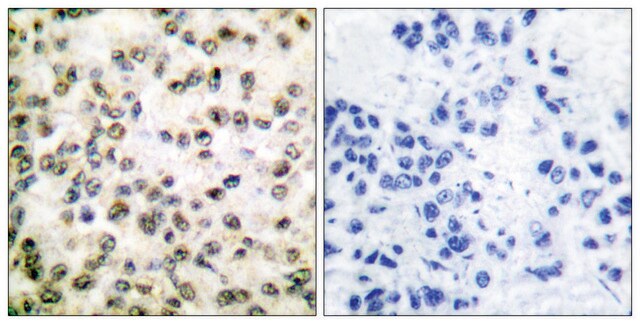 Anti-CREB-BP antibody produced in rabbit affinity isolated antibody