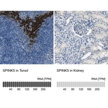 Anti-SPINK5 antibody produced in rabbit Prestige Antibodies&#174; Powered by Atlas Antibodies, affinity isolated antibody, buffered aqueous glycerol solution