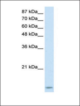 Anti-TARBP2 antibody produced in rabbit IgG fraction of antiserum