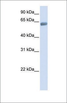 抗SLC47A2抗体 ウサギ宿主抗体 affinity isolated antibody