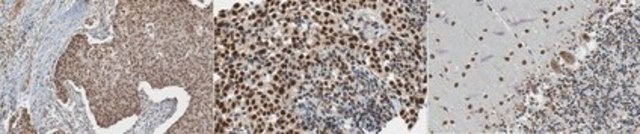 Anti-SMARCA3 (HLTF) Antibody, clone 11-1 clone 11-1, from mouse