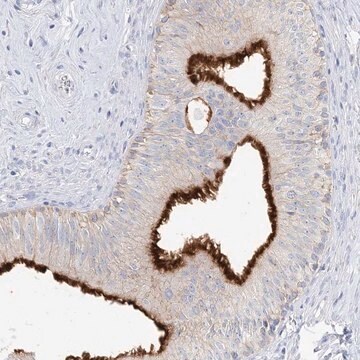 Anti-SLC5A6 antibody produced in rabbit Prestige Antibodies&#174; Powered by Atlas Antibodies, affinity isolated antibody, buffered aqueous glycerol solution