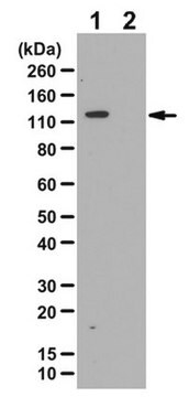 Anti-phospho-ULK1/ATG1 (Ser758)-Antikörper from rabbit, purified by affinity chromatography