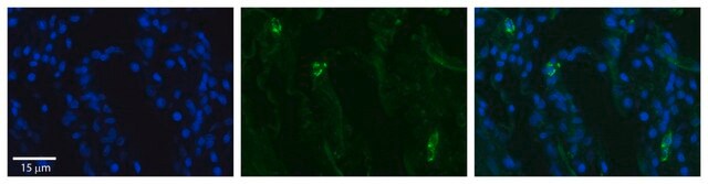 抗SLCO2B1抗体 ウサギ宿主抗体 affinity isolated antibody