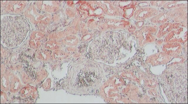 Anti-ACE2 antibody produced in rabbit affinity isolated antibody, buffered aqueous solution