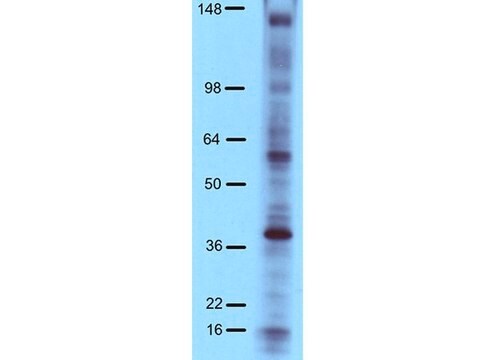 抗磷酸酪氨酸抗体，4G10&#174; 铂，HRP结合物 Upstate&#174;, from mouse, peroxidase conjugate