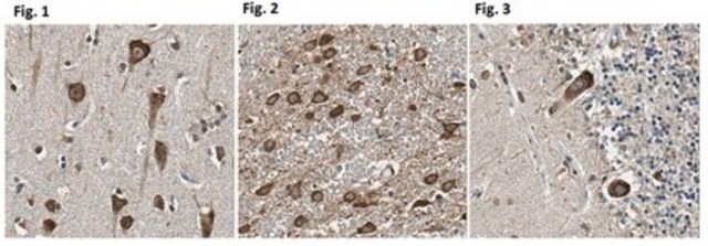 Anti-Cadherin-11/OB Cadherin Antibody from rabbit, purified by affinity chromatography