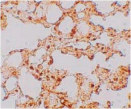 Anti-ZIP-6 Antibody from rabbit, purified by affinity chromatography