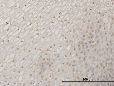 Monoclonal Anti-ERN1 antibody produced in mouse clone 3D1, purified immunoglobulin, buffered aqueous solution