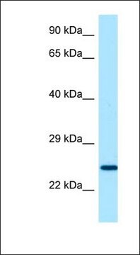 Anti-SOSTDC1 antibody produced in rabbit affinity isolated antibody