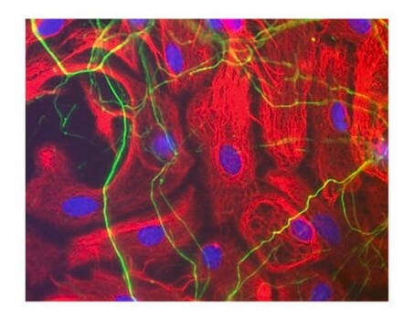 Neurofilament Antibodies Investigator Antibody Mini-Pack anti-neurofilament H&amp;M antibody, anti-neurofilament H antibody, and anti-neurofilament L antibody