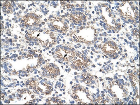 Anti-ARG1 IgG fraction of antiserum