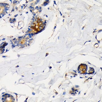 Anti-Mammaglobin A antibody produced in rabbit