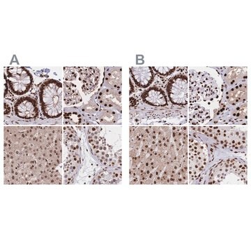 Anti-HDGF antibody produced in rabbit Prestige Antibodies&#174; Powered by Atlas Antibodies, affinity isolated antibody, buffered aqueous glycerol solution