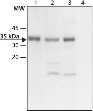 Anti-CHIP (extrémité C-terminale) antibody produced in rabbit ~1&#160;mg/mL, affinity isolated antibody, buffered aqueous solution