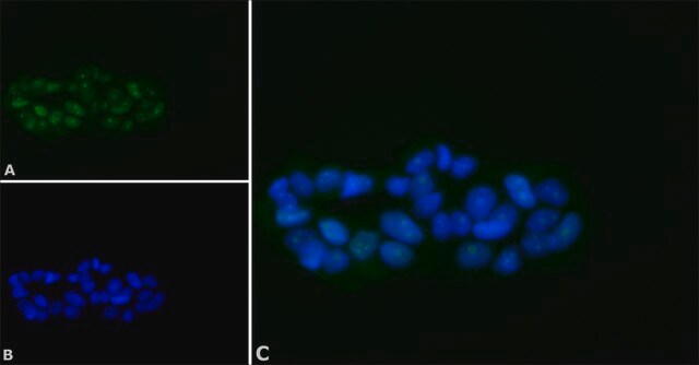 Anti-BACH1 antibody produced in rabbit affinity isolated antibody, buffered aqueous solution