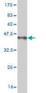 Monoclonal Anti-FOXP1 antibody produced in mouse clone 4E3-G11, purified immunoglobulin, buffered aqueous solution