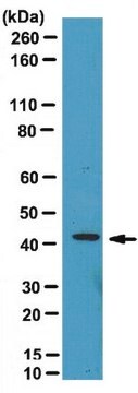 Anti-Endophilin-A1 Antibody from rabbit, purified by affinity chromatography