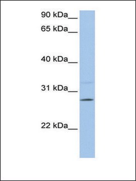 抗PEMT抗体 ウサギ宿主抗体 affinity isolated antibody