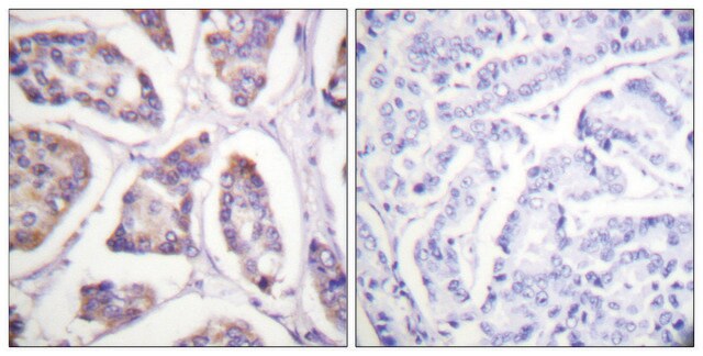 抗-黏着斑蛋白 兔抗 affinity isolated antibody