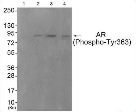 抗-磷酸雄激素受体（pTyr363） 兔抗 affinity isolated antibody