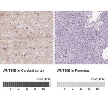 Anti-WNT10B antibody produced in rabbit Prestige Antibodies&#174; Powered by Atlas Antibodies, affinity isolated antibody, buffered aqueous glycerol solution