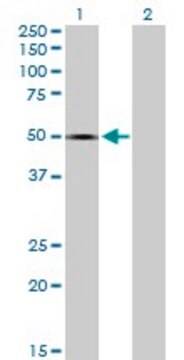 Anti-SPOCK1 antibody produced in mouse purified immunoglobulin, buffered aqueous solution