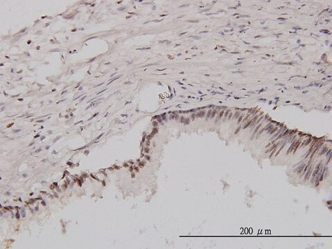 モノクローナル抗CSE1L抗体 マウス宿主抗体 clone 3D8, purified immunoglobulin, buffered aqueous solution