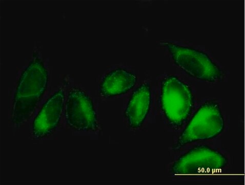 Anti-ALDH3A2 antibody produced in mouse purified immunoglobulin, buffered aqueous solution