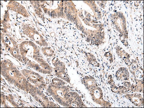 Anti-IL15 affinity isolated antibody