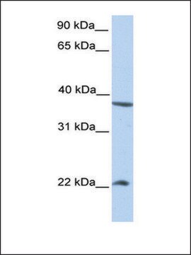 Anti-NEK7 antibody produced in rabbit affinity isolated antibody