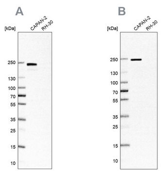 抗-ITGB4 兔抗 Prestige Antibodies&#174; Powered by Atlas Antibodies, affinity isolated antibody, buffered aqueous glycerol solution