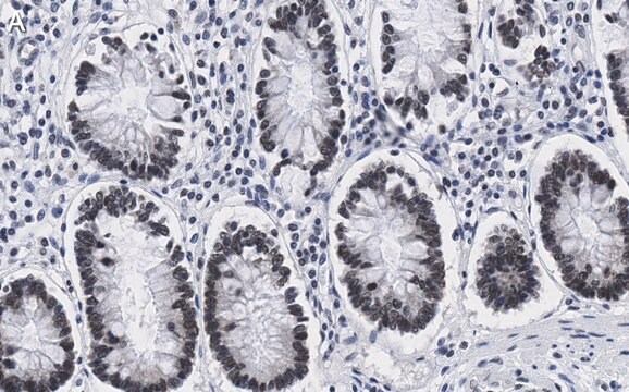 Anti-ZNF638 Antibody, clone 4C19 ZooMAb&#174; Rabbit Monoclonal recombinant, expressed in HEK 293 cells