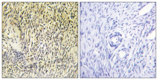 Anti-SYK antibody produced in rabbit affinity isolated antibody